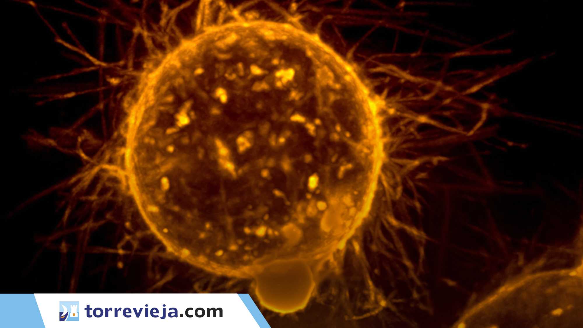 El melanoma y su metástasis cerebral, claves para su prevención torrevieja